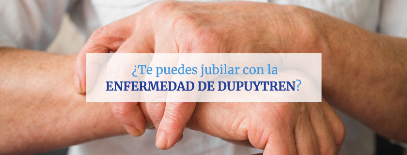 ¿Te puedes jubilar con la enfermedad de Dupuytren?