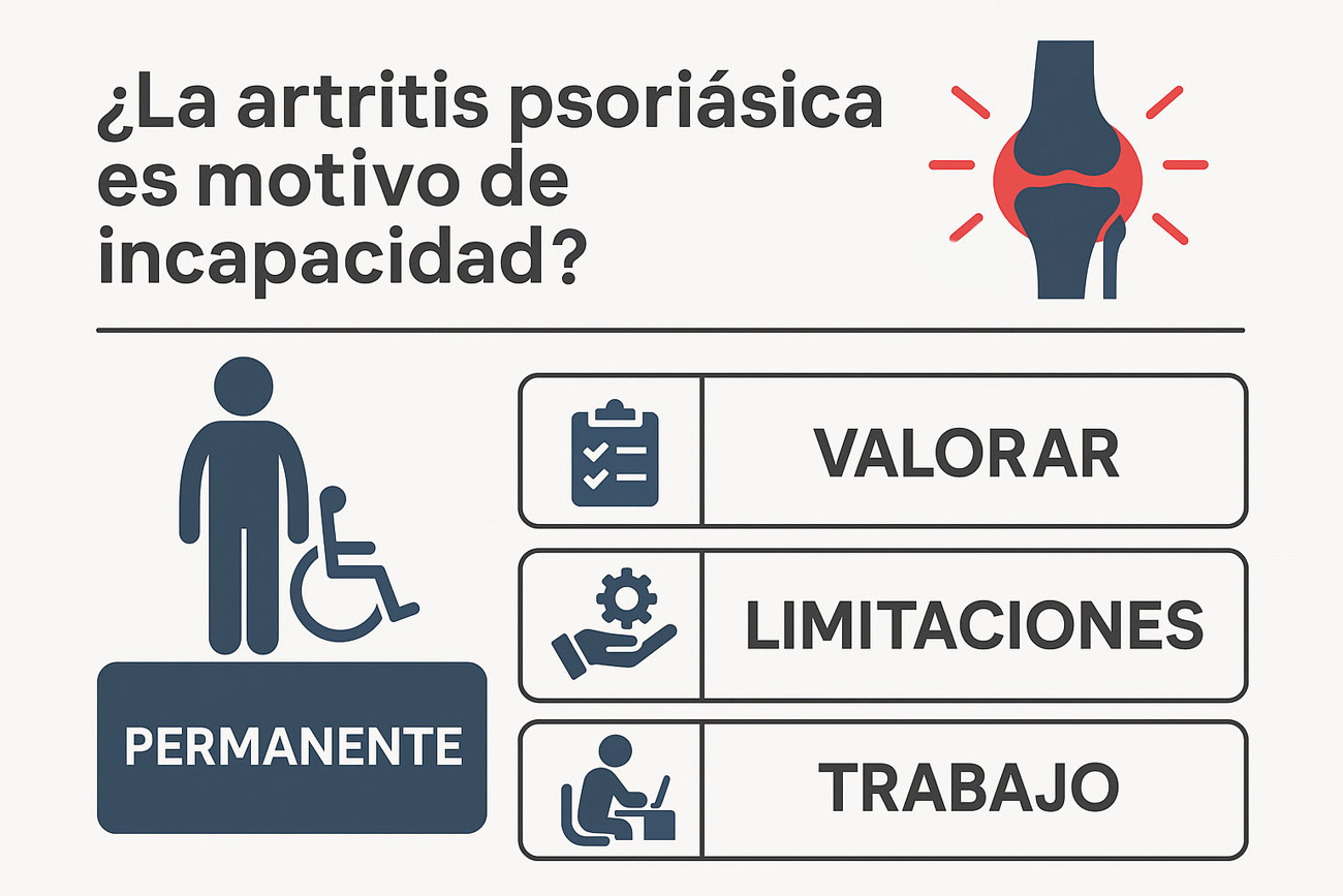 La artritis psoriásica es motivo de incapacidad permanente