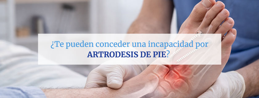 Te pueden conceder una incapacidad por artrodesis de pie