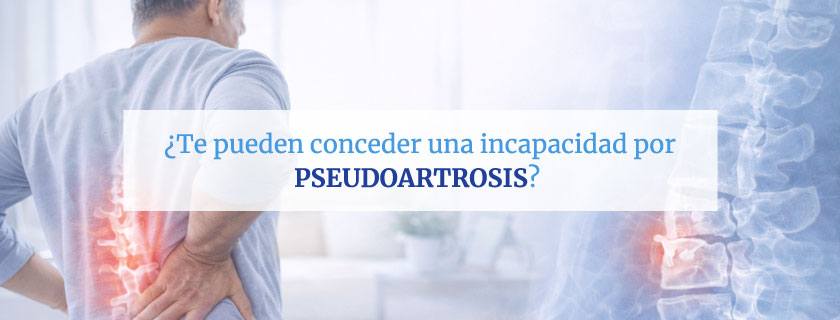 Te pueden conceder una incapacidad por pseudoartrosis